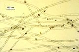 Discosporangium mesarthrocarpum5